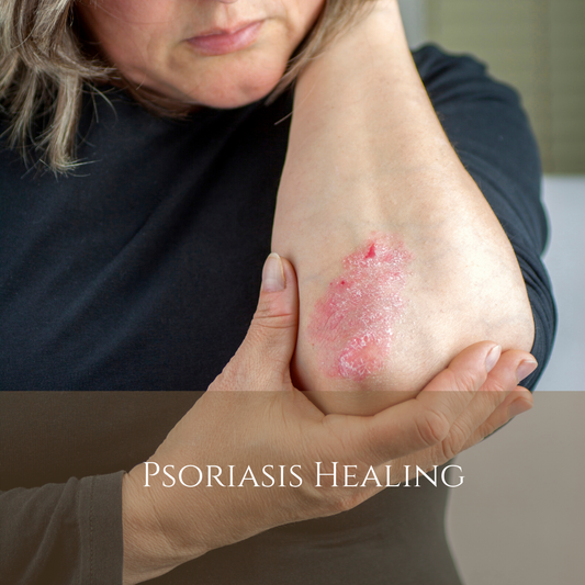 Psoriasis: Healing from the Inside Out