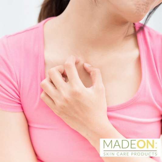 Woman with itchy skin from eczema from food 