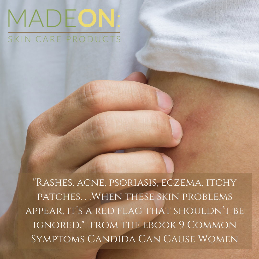 Is my Skin Issue (psoriasis, acne, itchy skin) a Symptom of Candida?
