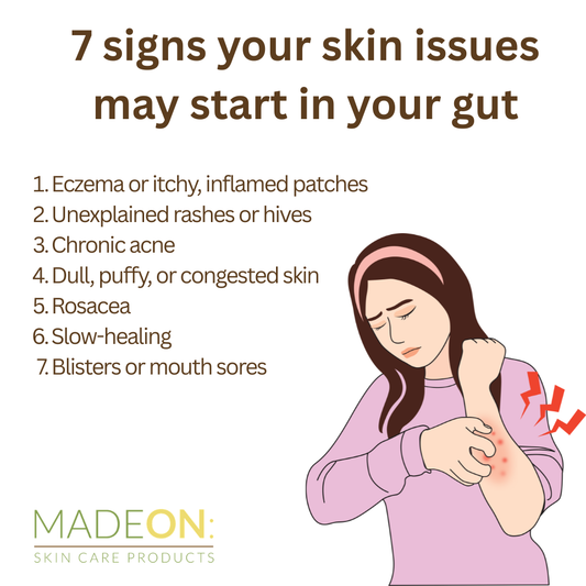 The Gut-Skin Connection: How Your Gut Health Affects Eczema and Skin Rashes