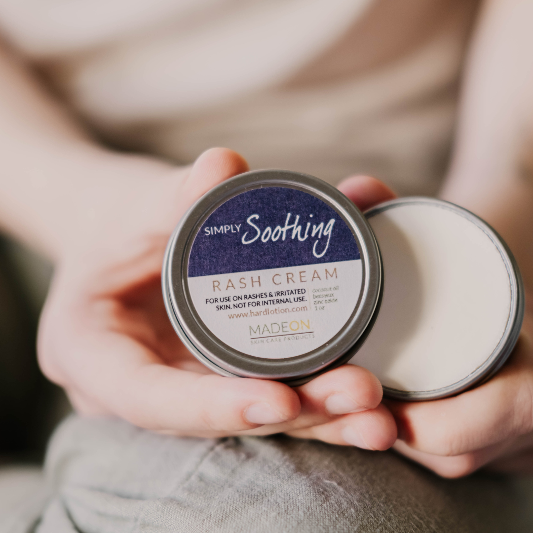 woman showing Simply Soothing Rash Cream in the 1 oz tin